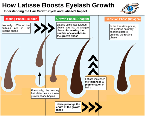 How does latisse work